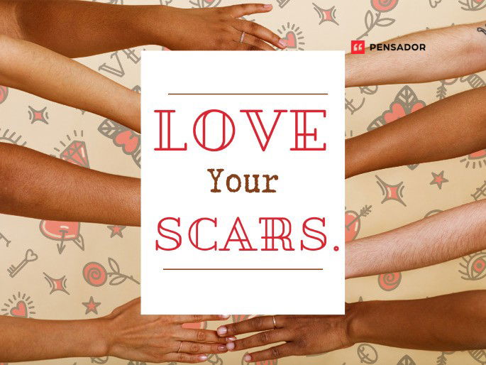 Love Your Scars.