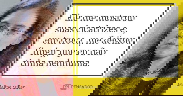 Ele me mostrou suas cicatrizes e, em troca, me deixou fingir que eu não tinha nenhuma.... Frase de Madeline Miller.
