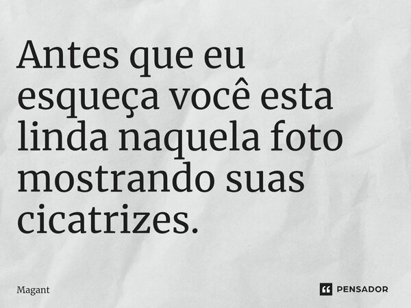 ⁠Antes que eu esqueça você esta linda naquela foto mostrando suas cicatrizes.... Frase de Magant.